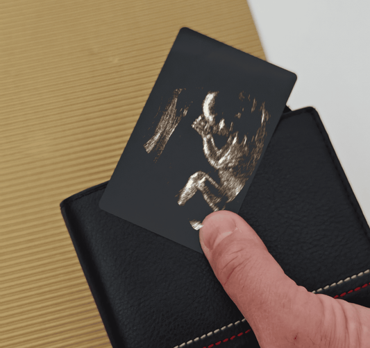 Card portofel personalizat cu ecografie – cadou special pentru viitorul tătic.