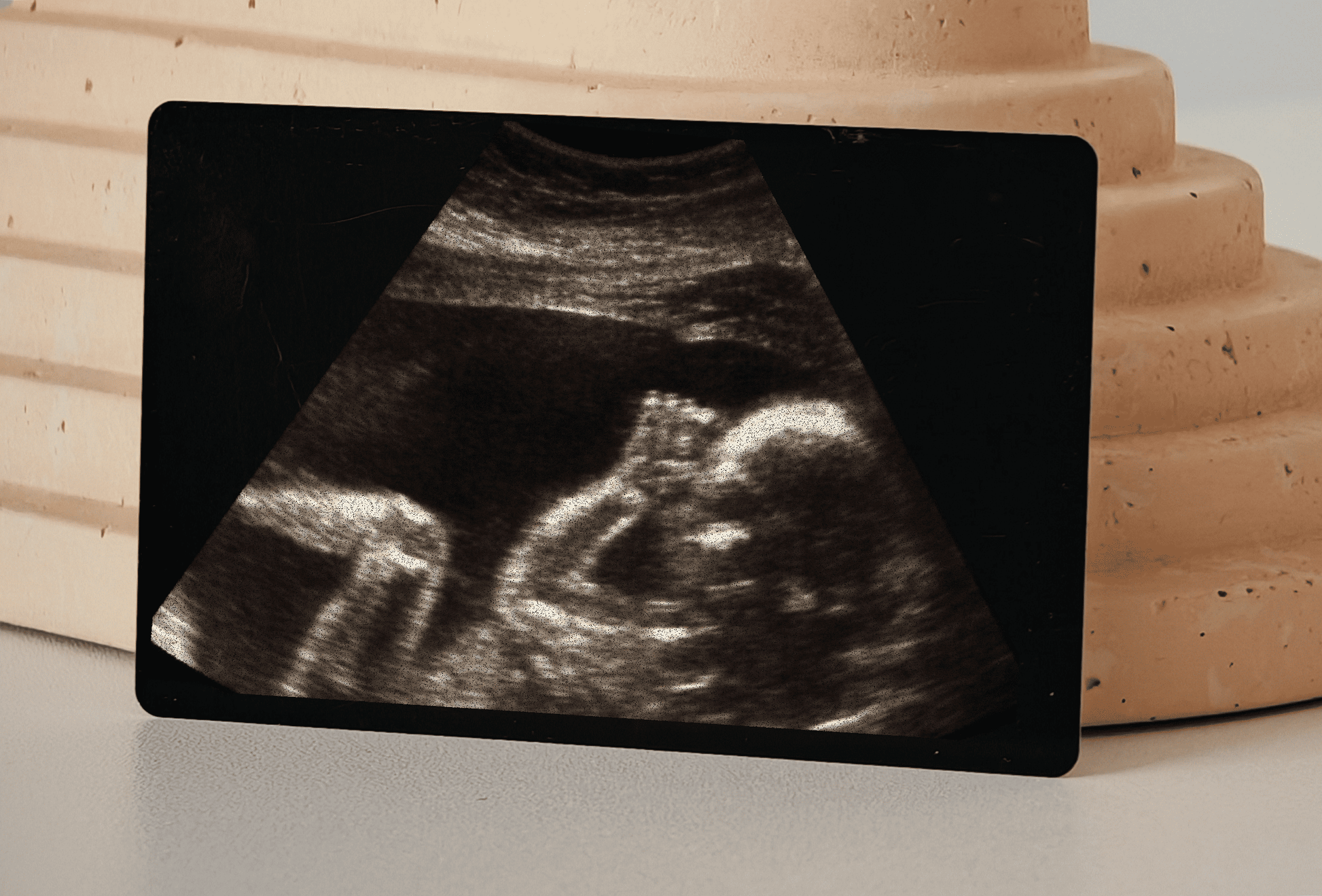 Card din metal cu imaginea sonogramei – anunț original de sarcină pentru el.